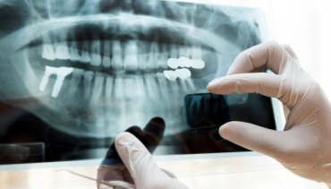 Radiología dental