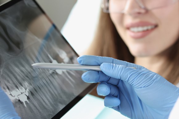 Rehabilitación oral, reconstrucción dental, Dentalhábilis Clínica Dental