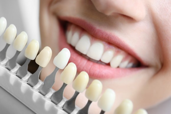 Blanqueamiento dental, blanquear dientes, Clínica Dental Dentalhábilis