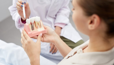 Implantes dentales