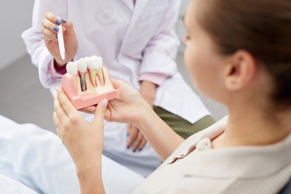 Implantes dentales, implantología, Clínica Dental Dentalhábilis