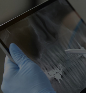 Rehabilitación dental - Dentalhábilis