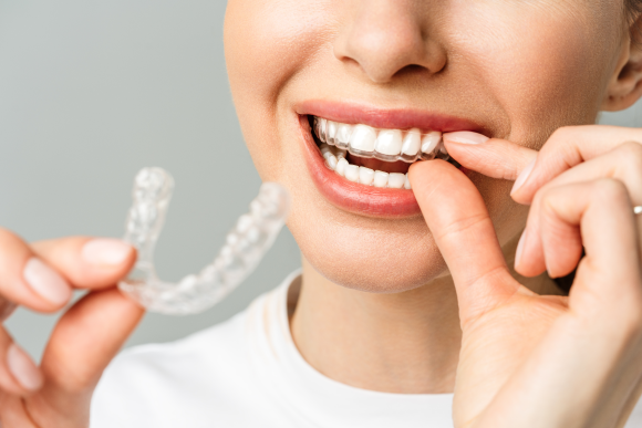 Ortodoncia invisible, ortodoncia adultos, adolescentes, Dentalhábilis